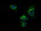 ATP Synthase F1 Subunit Beta antibody, LS-C114910, Lifespan Biosciences, Immunofluorescence image 