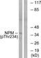 Nucleophosmin 1 antibody, PA5-38787, Invitrogen Antibodies, Western Blot image 