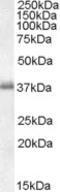 Solute Carrier Family 7 Member 5 antibody, EB06418, Everest Biotech, Western Blot image 