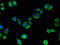 Collagenase 3 antibody, A55291-100, Epigentek, Immunofluorescence image 