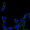 Protein Tyrosine Kinase 2 antibody, NBP2-22168, Novus Biologicals, Immunocytochemistry image 