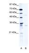 Tripartite Motif Containing 17 antibody, NBP1-80044, Novus Biologicals, Western Blot image 
