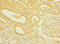 Roundabout Guidance Receptor 2 antibody, LS-C676412, Lifespan Biosciences, Immunohistochemistry paraffin image 