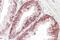 Catenin Alpha 1 antibody, GTX89347, GeneTex, Immunohistochemistry paraffin image 