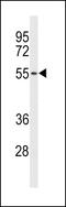 BNC1 antibody, MBS9213210, MyBioSource, Western Blot image 