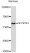 Solute Carrier Family 47 Member 1 antibody, A14559, ABclonal Technology, Western Blot image 