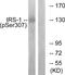 Insulin Receptor Substrate 1 antibody, LS-C117387, Lifespan Biosciences, Western Blot image 