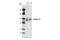 Integrin Subunit Beta 5 antibody, 4708S, Cell Signaling Technology, Western Blot image 