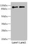 TLCN antibody, LS-C675879, Lifespan Biosciences, Western Blot image 