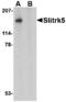 SLIT And NTRK Like Family Member 5 antibody, A10564, Boster Biological Technology, Western Blot image 