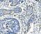 Autophagy Related 16 Like 1 antibody, A00526-3, Boster Biological Technology, Immunohistochemistry paraffin image 