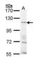 Transient receptor potential cation channel subfamily M member 8 antibody, PA5-29382, Invitrogen Antibodies, Western Blot image 