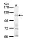 Transient Receptor Potential Cation Channel Subfamily M Member 8 antibody, PA5-29382, Invitrogen Antibodies, Western Blot image 