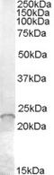 Anti-Silencing Function 1A Histone Chaperone antibody, EB07788, Everest Biotech, Western Blot image 