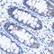 Ribonucleotide Reductase Catalytic Subunit M1 antibody, GTX54666, GeneTex, Immunohistochemistry paraffin image 
