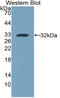 MyHC-slow antibody, MBS2007182, MyBioSource, Western Blot image 