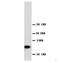 Glutathione S-Transferase Pi 1 antibody, orb18037, Biorbyt, Western Blot image 