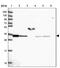 NSF Attachment Protein Alpha antibody, NBP2-33593, Novus Biologicals, Western Blot image 