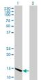 Chromatin Accessibility Complex Subunit 1 antibody, H00054108-M11, Novus Biologicals, Western Blot image 