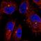 Centrosomal Protein 350 antibody, NBP2-55557, Novus Biologicals, Immunocytochemistry image 