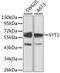 Synaptotagmin 1 antibody, 13-358, ProSci, Western Blot image 