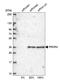 Protein Activator Of Interferon Induced Protein Kinase EIF2AK2 antibody, HPA034997, Atlas Antibodies, Western Blot image 