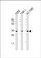 Transmembrane Protein 158 (Gene/Pseudogene) antibody, PA5-49532, Invitrogen Antibodies, Western Blot image 