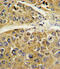 Serpin Family A Member 7 antibody, LS-C168982, Lifespan Biosciences, Immunohistochemistry frozen image 