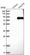 Polypeptide N-Acetylgalactosaminyltransferase 6 antibody, PA5-53552, Invitrogen Antibodies, Western Blot image 