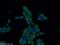 Transmembrane Protein 141 antibody, 16092-1-AP, Proteintech Group, Immunofluorescence image 