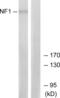 Neurofibromin 1 antibody, abx014052, Abbexa, Western Blot image 