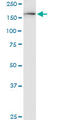 Lysine Demethylase 6A antibody, LS-C198418, Lifespan Biosciences, Western Blot image 