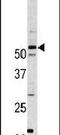 Cyclin Dependent Kinase 14 antibody, PA5-14483, Invitrogen Antibodies, Western Blot image 