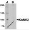 KN motif and ankyrin repeat domain-containing protein 2 antibody, 7309, ProSci Inc, Western Blot image 