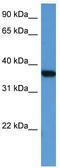 MAPK Activated Protein Kinase 2 antibody, TA342908, Origene, Western Blot image 