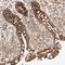 RNA methyltransferase-like protein 1 antibody, HPA023292, Atlas Antibodies, Immunohistochemistry frozen image 