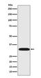 Protein Phosphatase 1 Regulatory Inhibitor Subunit 1B antibody, M03424, Boster Biological Technology, Western Blot image 