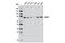 Kinesin Family Member C1 antibody, 12313S, Cell Signaling Technology, Western Blot image 
