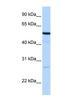 Receptor Accessory Protein 4 antibody, NBP1-62509, Novus Biologicals, Western Blot image 