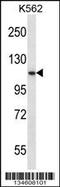 Proprotein Convertase Subtilisin/Kexin Type 6 antibody, 58-025, ProSci, Western Blot image 