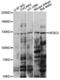 HECT And RLD Domain Containing E3 Ubiquitin Protein Ligase 5 antibody, LS-C749868, Lifespan Biosciences, Western Blot image 