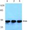 Phosphatase And Tensin Homolog antibody, A00006S364, Boster Biological Technology, Western Blot image 