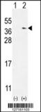 NME/NM23 Family Member 9 antibody, 55-561, ProSci, Western Blot image 