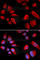 Cystathionine-Beta-Synthase antibody, A1427, ABclonal Technology, Immunofluorescence image 