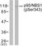 Nibrin antibody, LS-C117423, Lifespan Biosciences, Western Blot image 