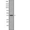 Aldo-Keto Reductase Family 1 Member C4 antibody, abx148109, Abbexa, Western Blot image 