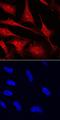 MYCL Proto-Oncogene, BHLH Transcription Factor antibody, PA5-47567, Invitrogen Antibodies, Immunocytochemistry image 