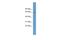 Acyl-CoA Thioesterase 11 antibody, A11581, Boster Biological Technology, Western Blot image 