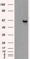 Checkpoint Kinase 2 antibody, TA500384BM, Origene, Western Blot image 