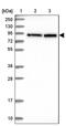 Transducin Beta Like 3 antibody, PA5-60024, Invitrogen Antibodies, Western Blot image 